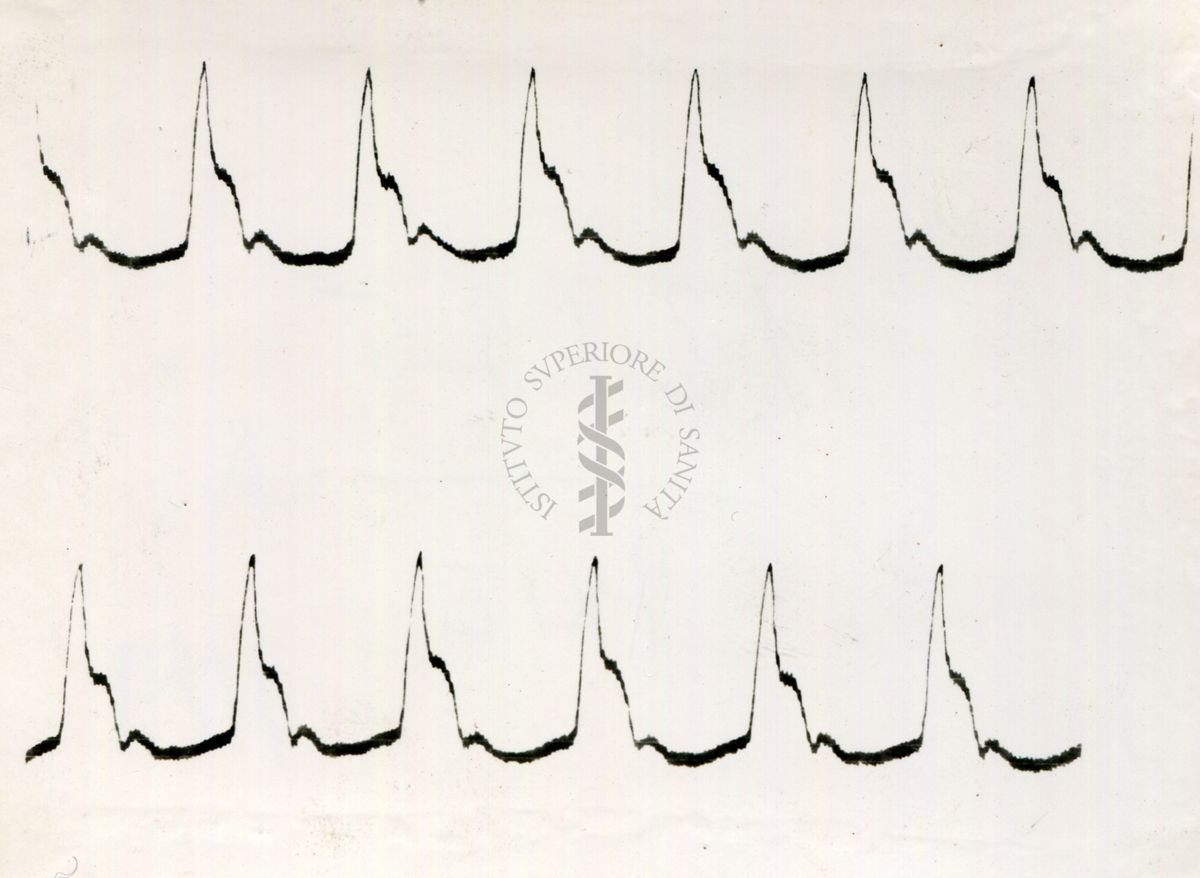 Registrazione piezografica del polso dell'arteria temporale nell'uomo sotto effetto di vari farmaci