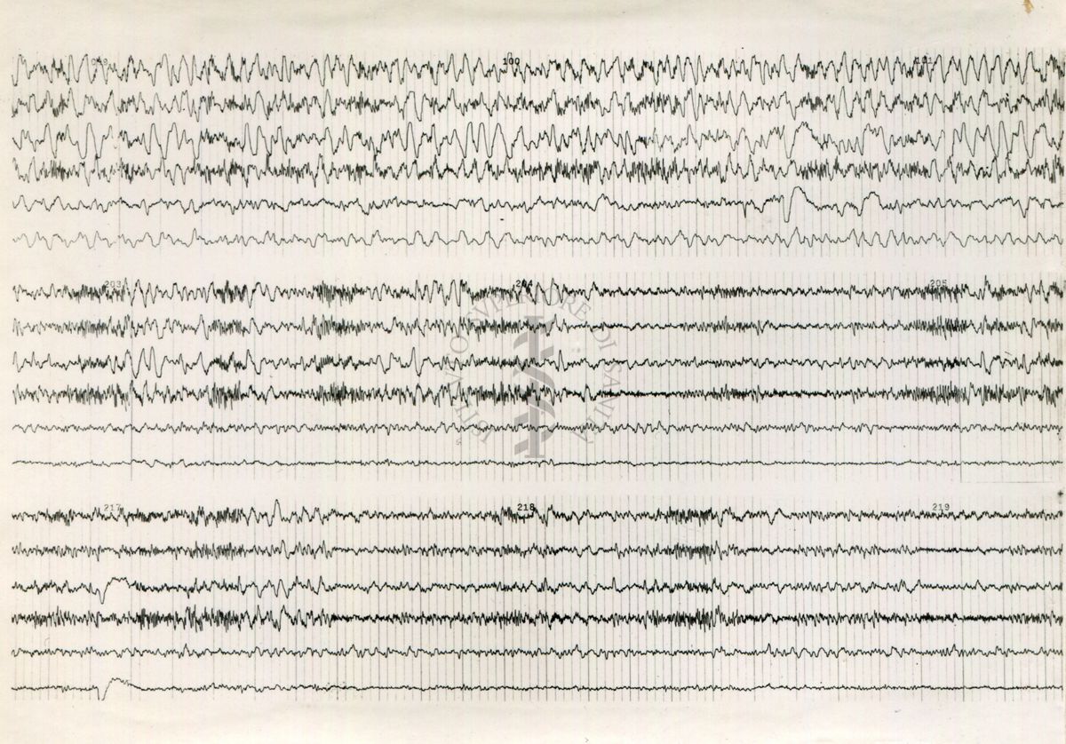 Tracciati elettroencefalografici di coniglio