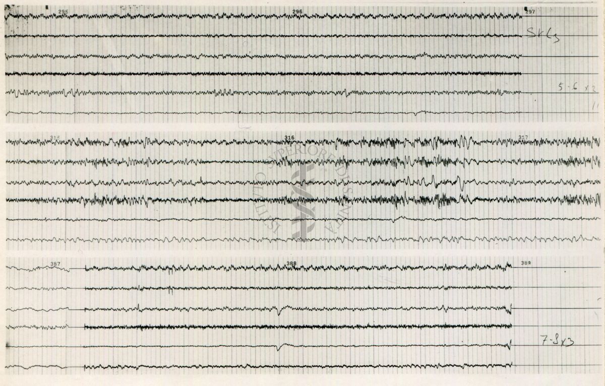 Tracciati elettroencefalografici di coniglio