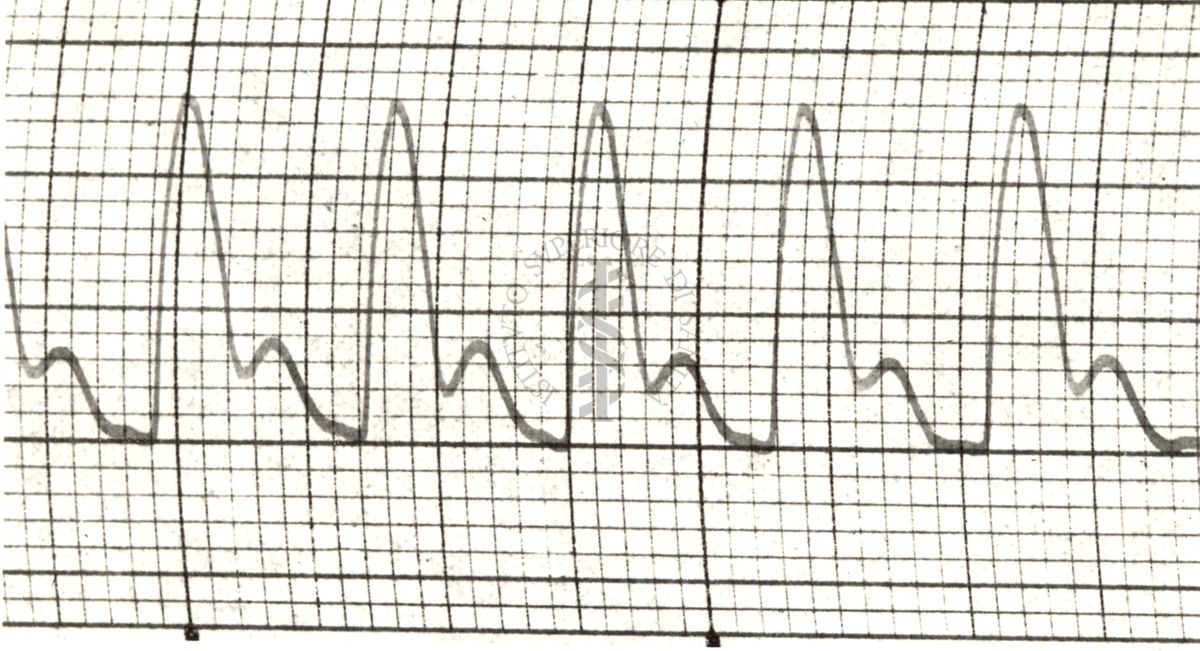 Polsazioni delle arterie nell'uomo