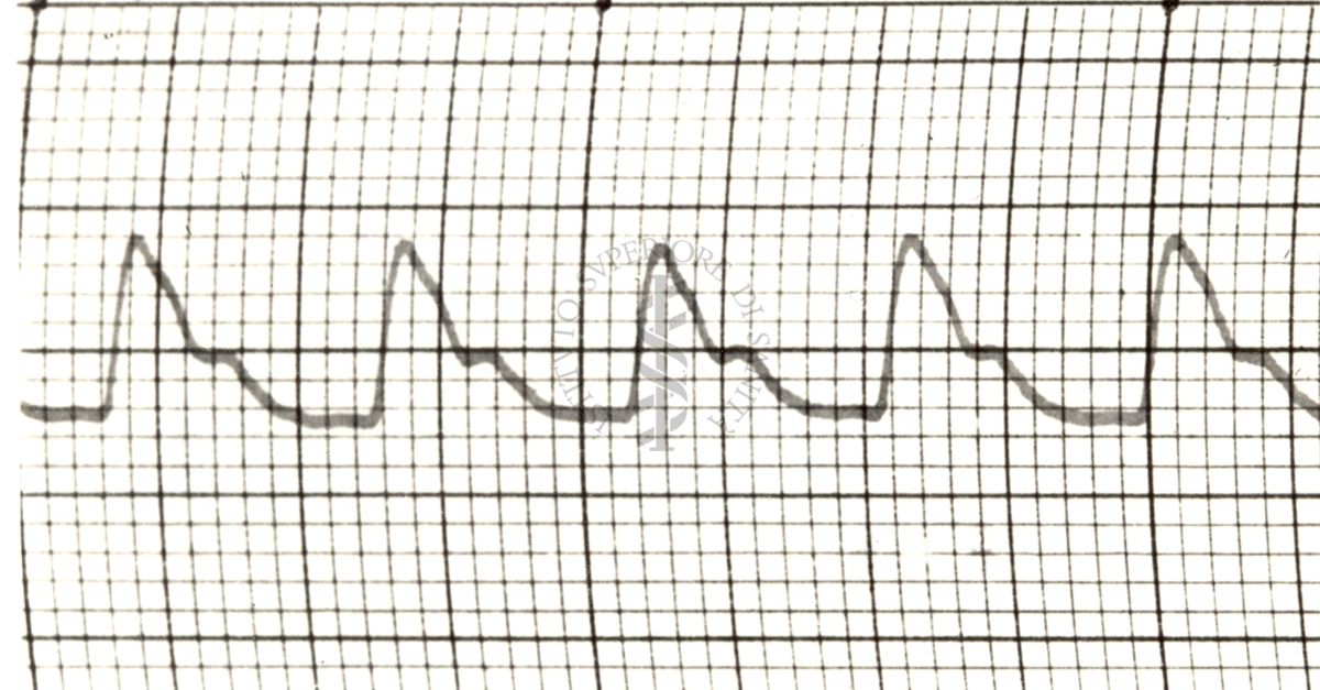 Polsazioni delle arterie nell'uomo