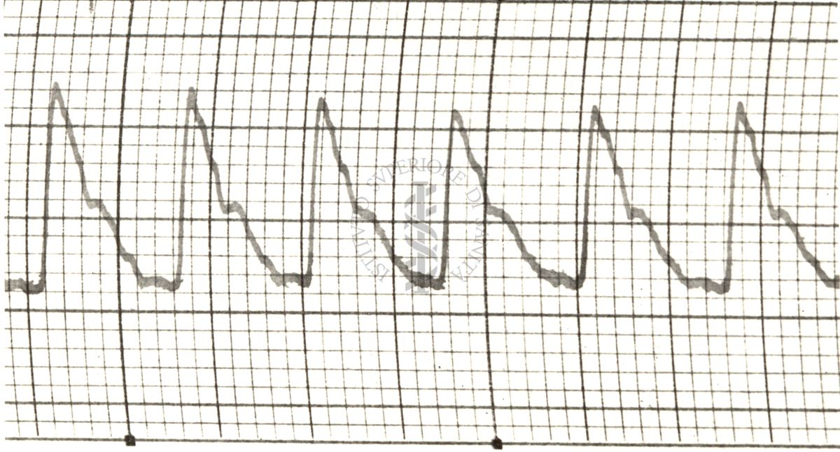 Polsazioni delle arterie nell'uomo