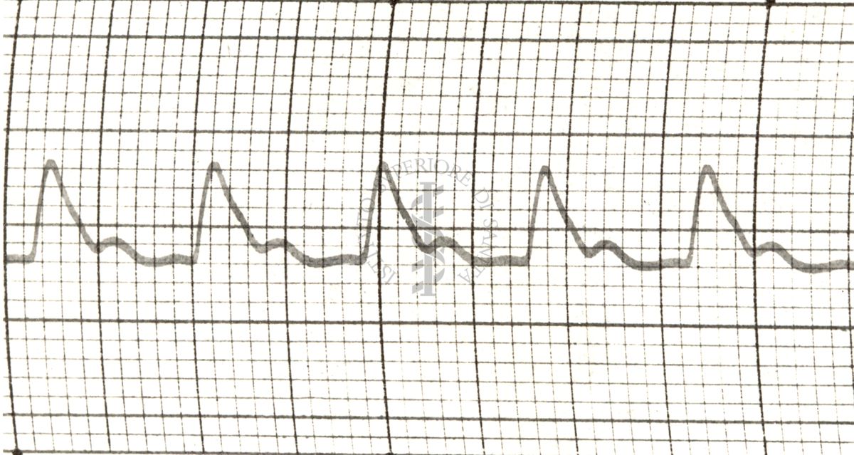 Polsazioni delle arterie nell'uomo