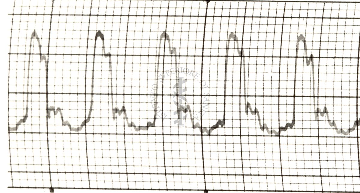 Polsazioni delle arterie nell'uomo