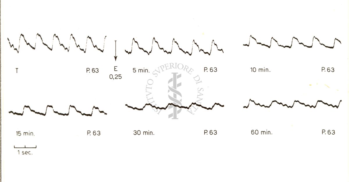 Registrazioni delle pulsazioni dell'arteria temporale nell'uomo sotto azione di vari farmaci