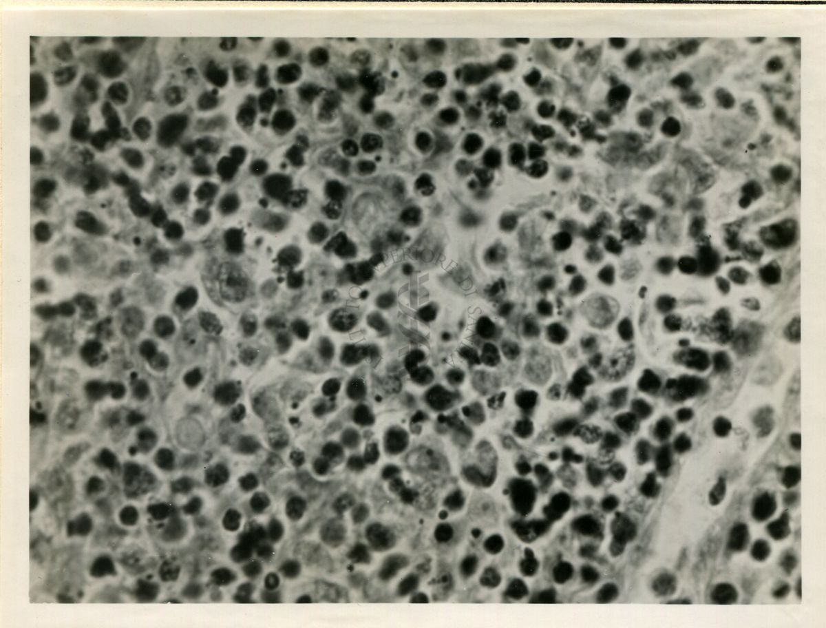 Cellule di linfoghiandole