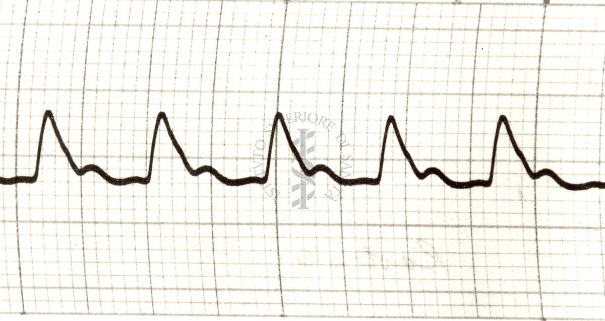 Piezosfigmogrammi delle principali arterie dell'uomo