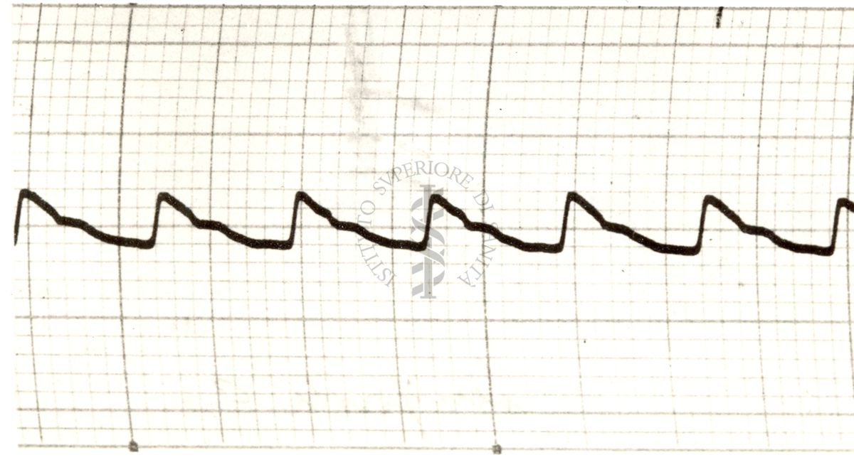 Piezosfigmogrammi delle principali arterie dell'uomo