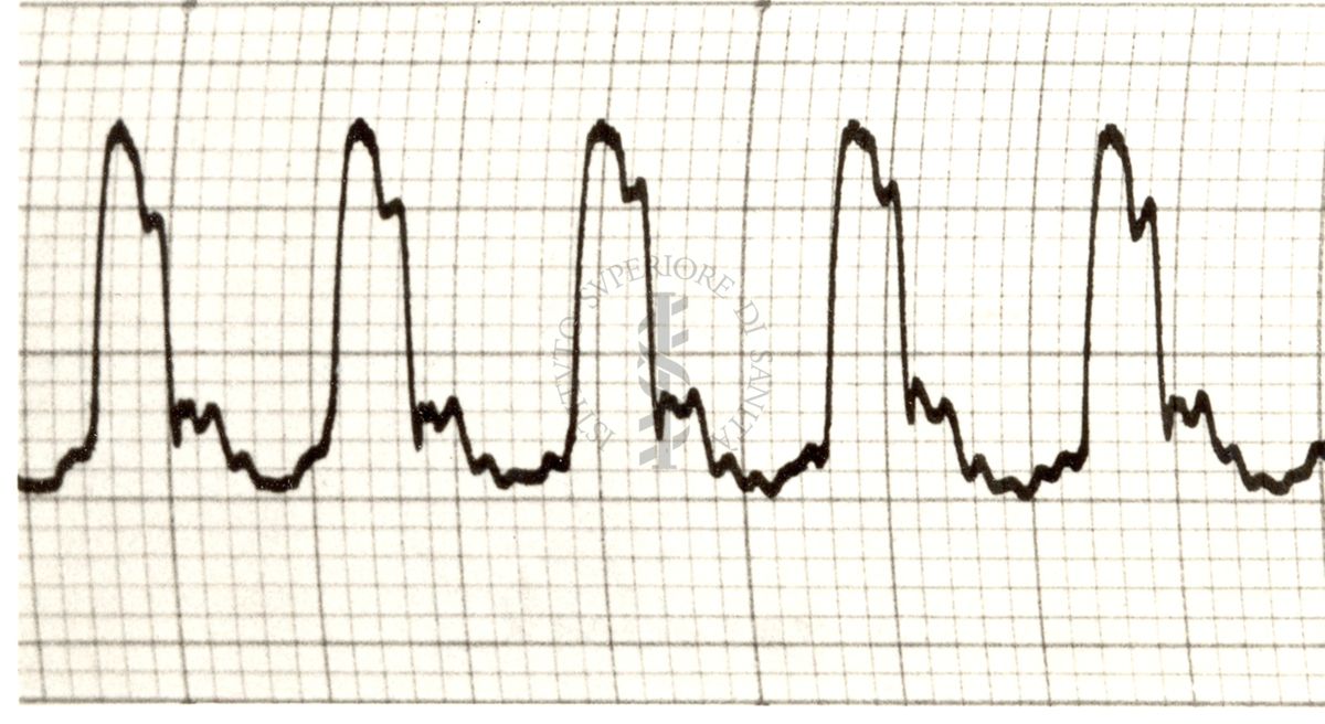 Piezosfigmogrammi delle principali arterie dell'uomo