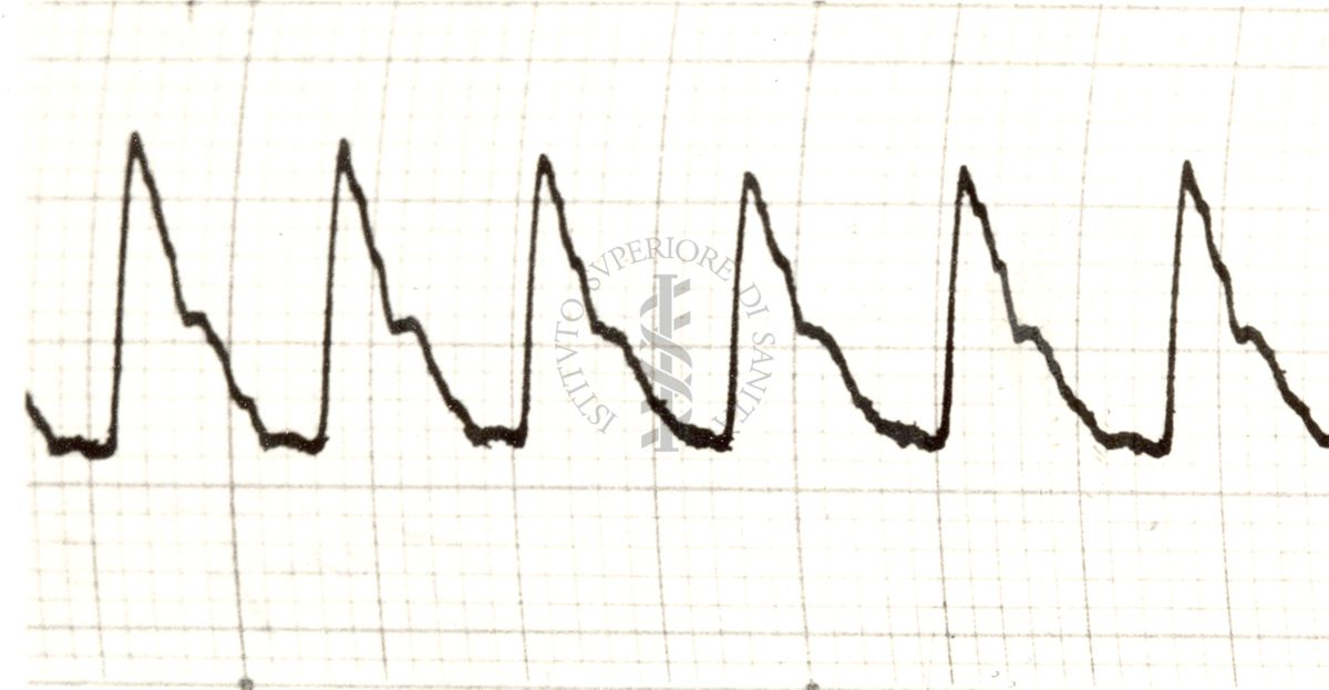 Piezosfigmogrammi delle principali arterie dell'uomo