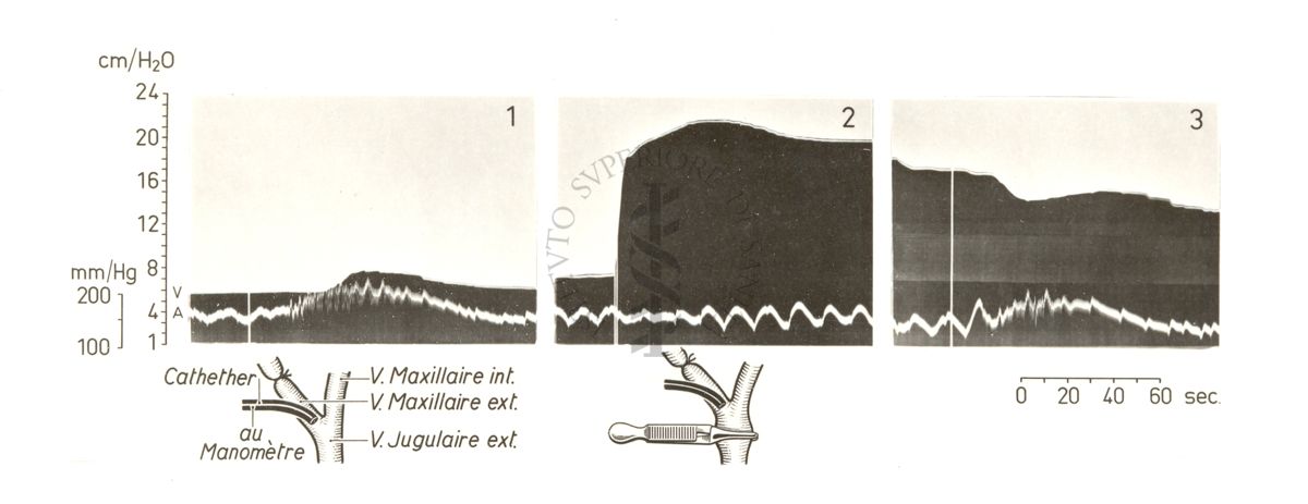 Grafico riguardante l'andrealina e circolo cerebrale