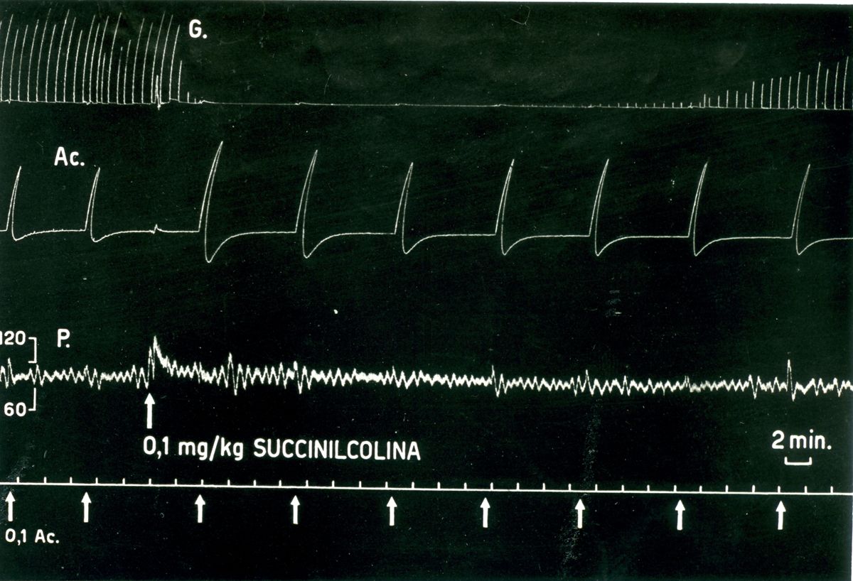 Tracciato che mostra l'azione sul cane dei Curari di sintesi derivati della succinilcolina