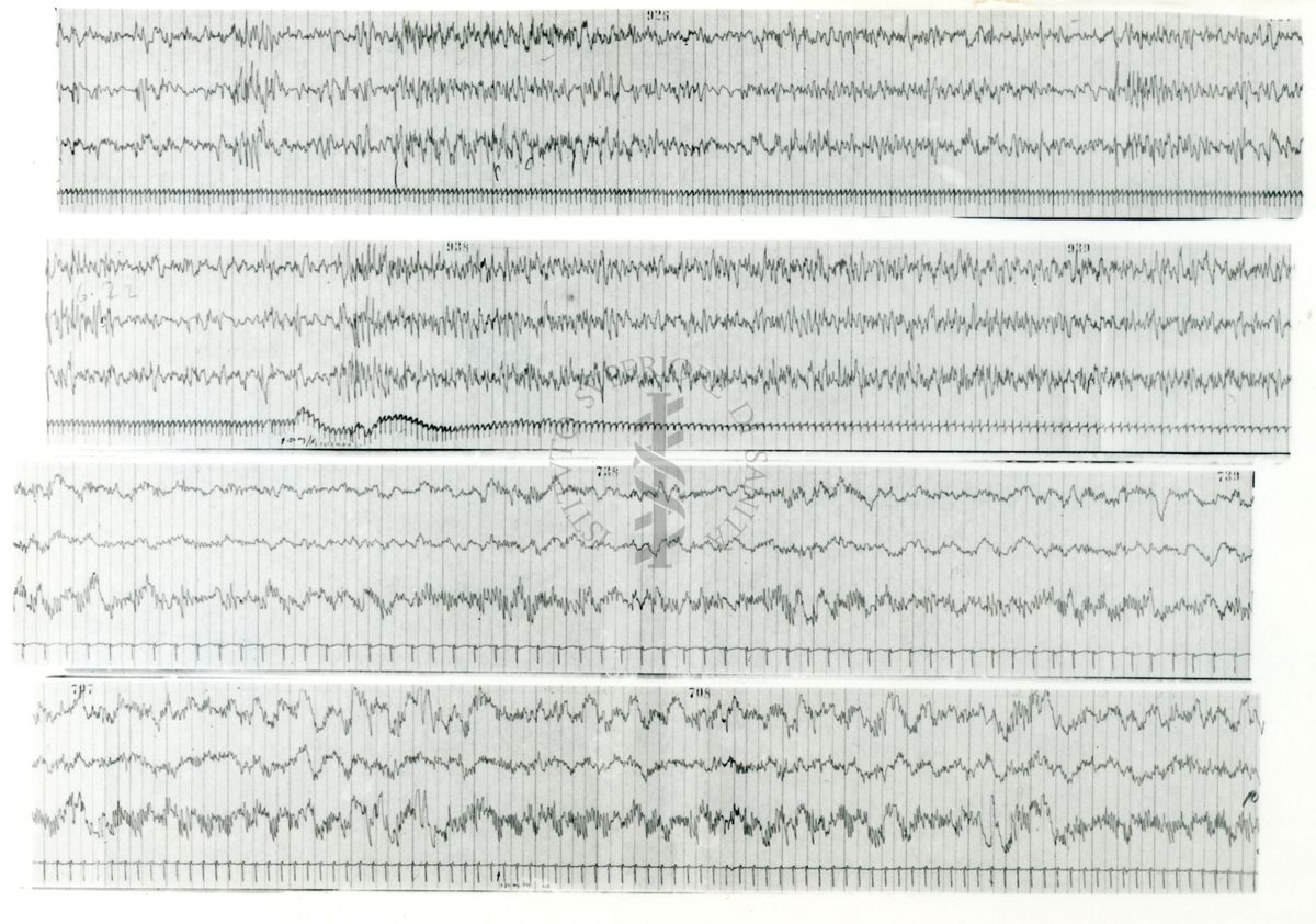 Tracciati elettroencefalografici di coniglio