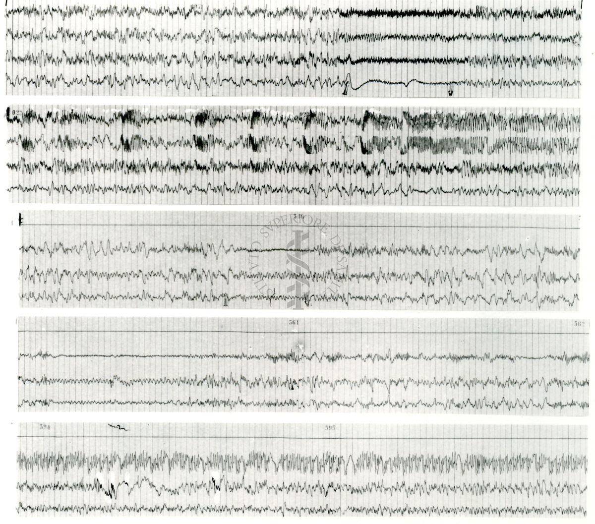 Tracciati elettroencefalografici di coniglio