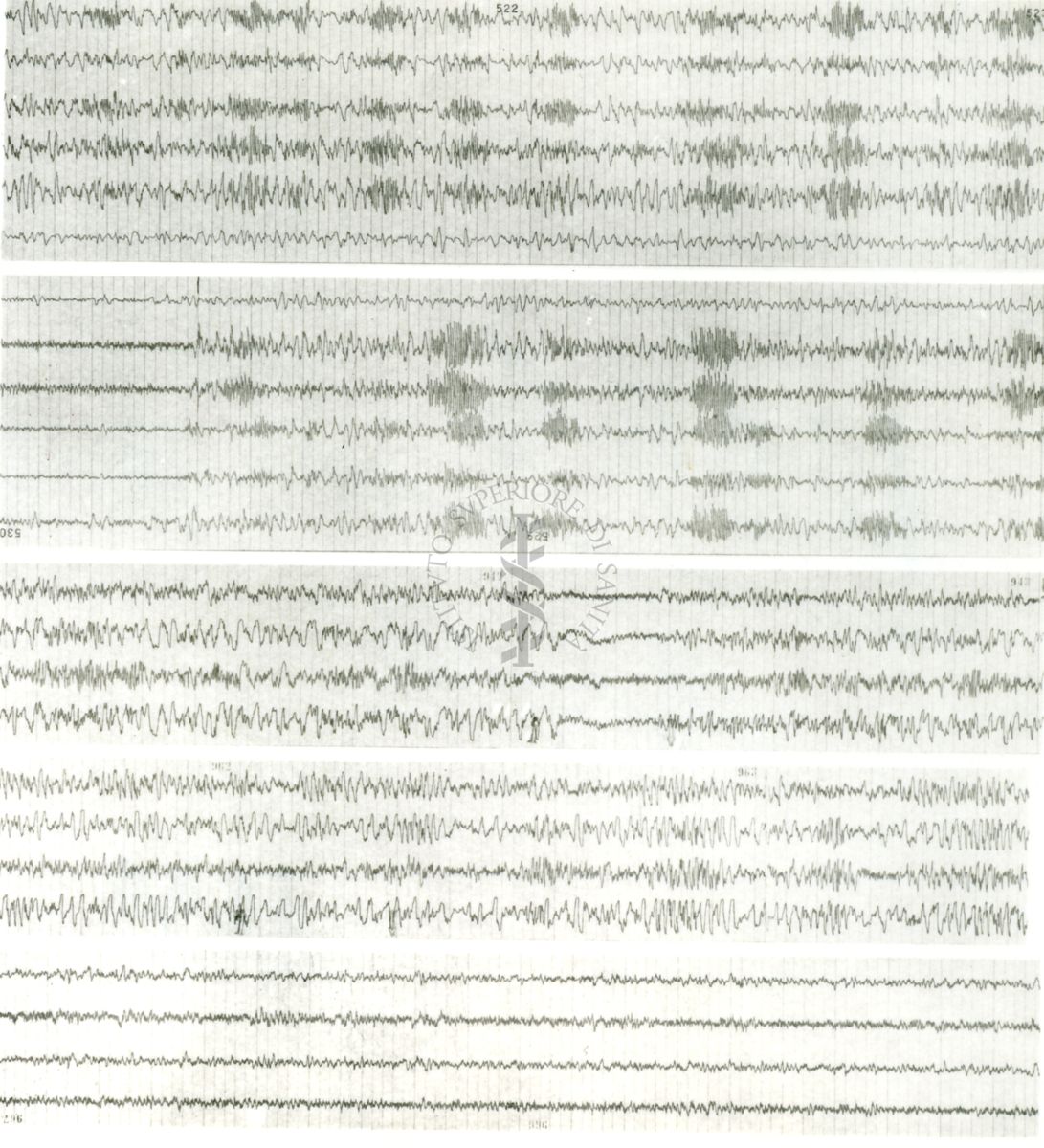 Tracciati elettroencefalografici di coniglio