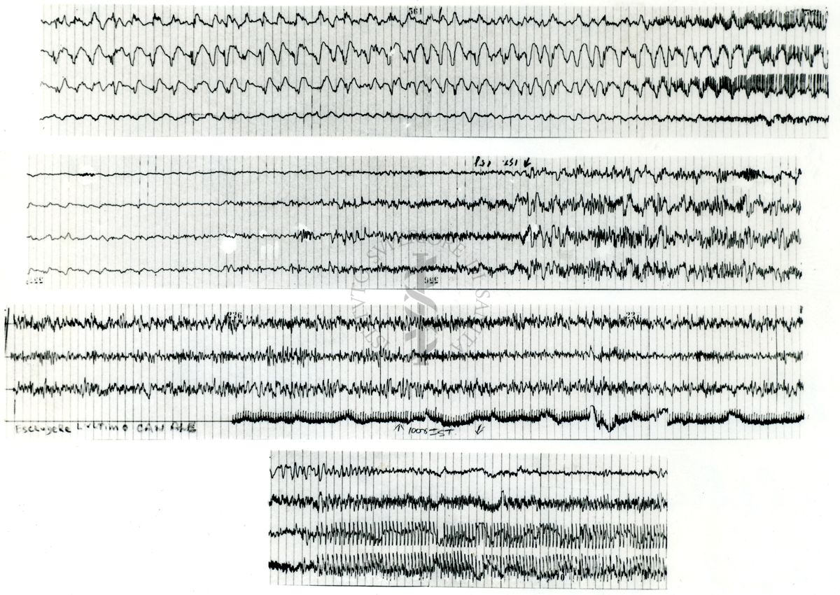 Tracciati elettroencefalografici di coniglio