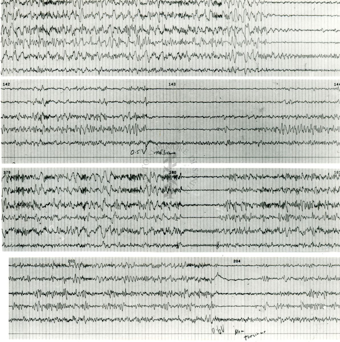 Tracciati elettroencefalografici di coniglio