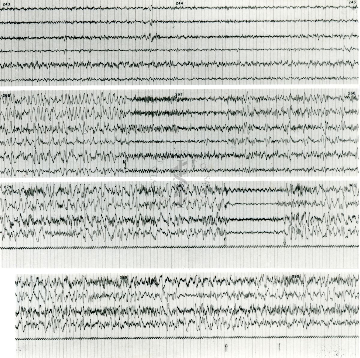 Tracciati elettroencefalografici di coniglio