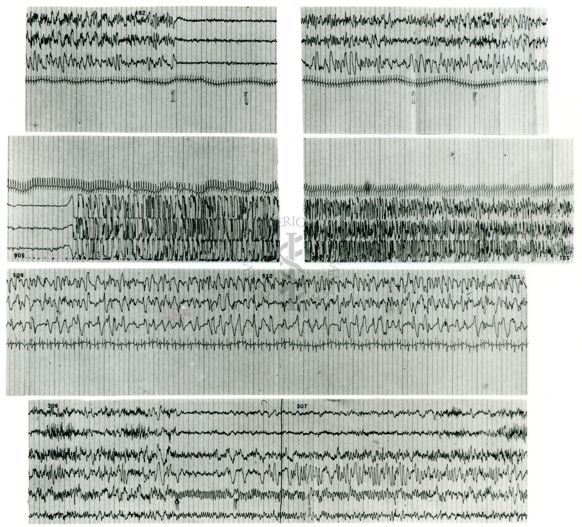 Tracciati elettroencefalografici di coniglio