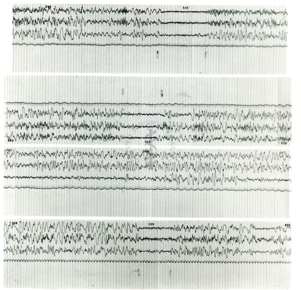 Tracciati elettroencefalografici di coniglio