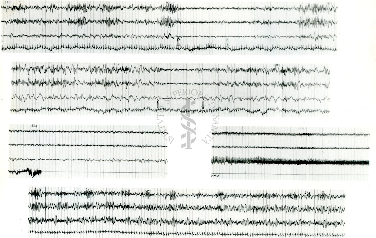 Tracciati elettroencefalografici di coniglio