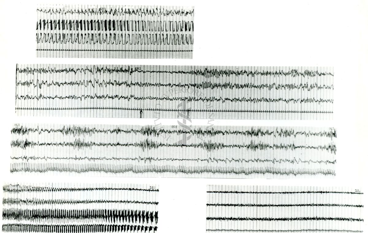 Tracciati elettroencefalografici di coniglio