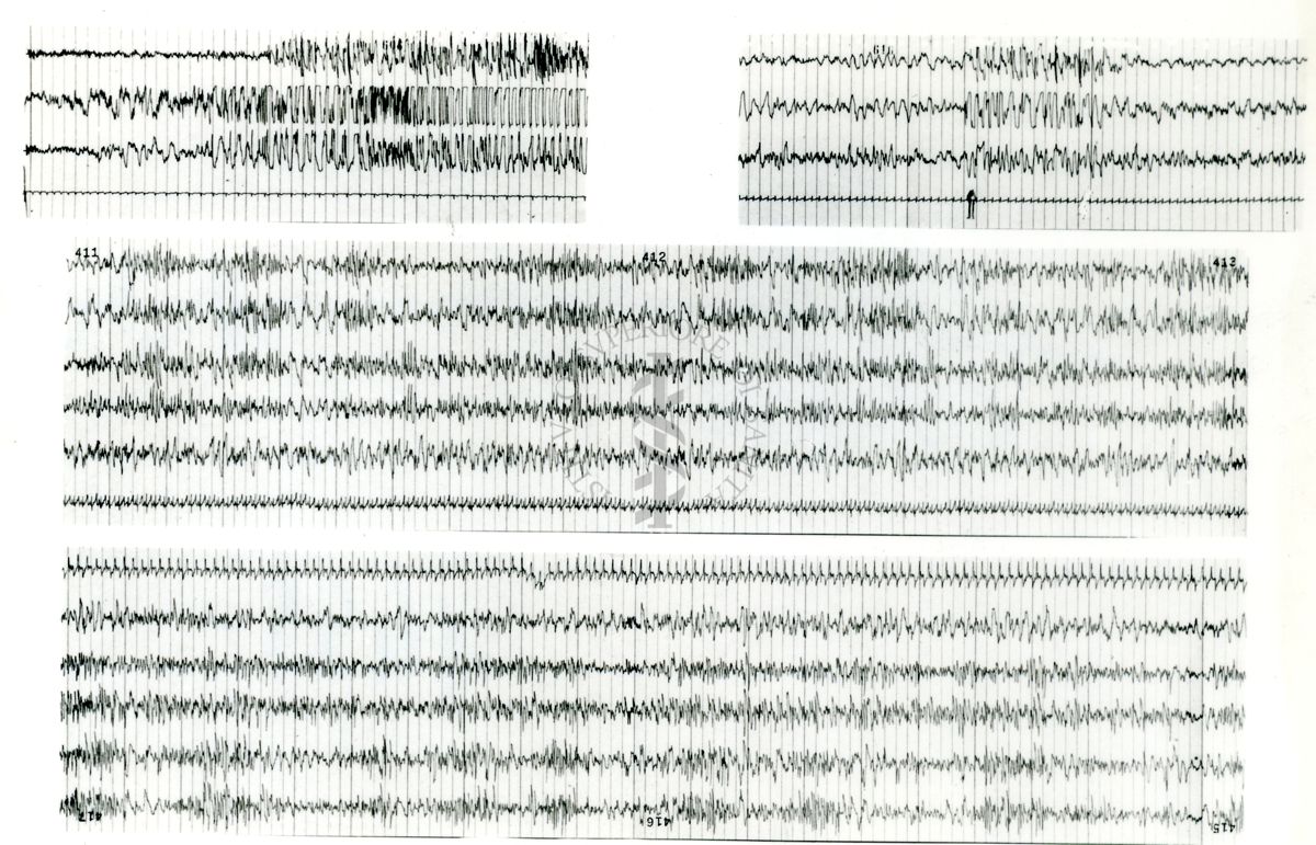 Tracciati elettroencefalografici di coniglio