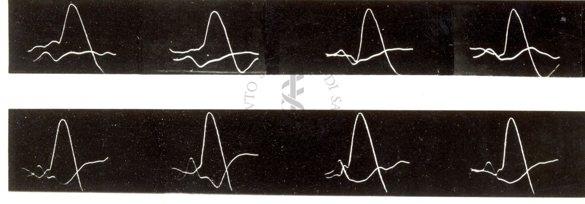 Tracciati elettroncefalografici di coniglio