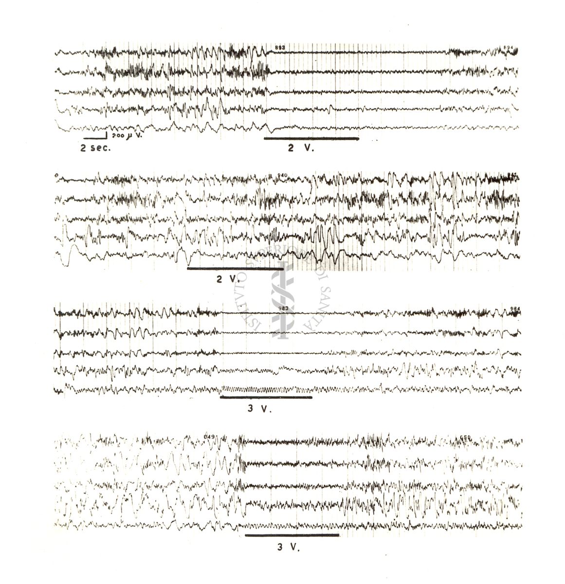 Tracciati elettroncefalografici di coniglio