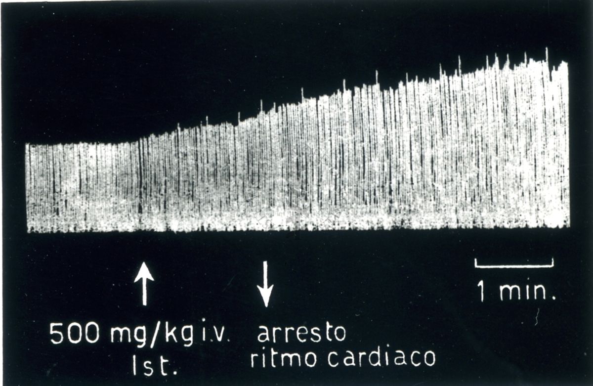 Tracciati broncografici