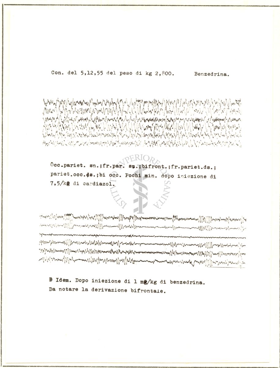 Elettroncefalogrammi di coniglio