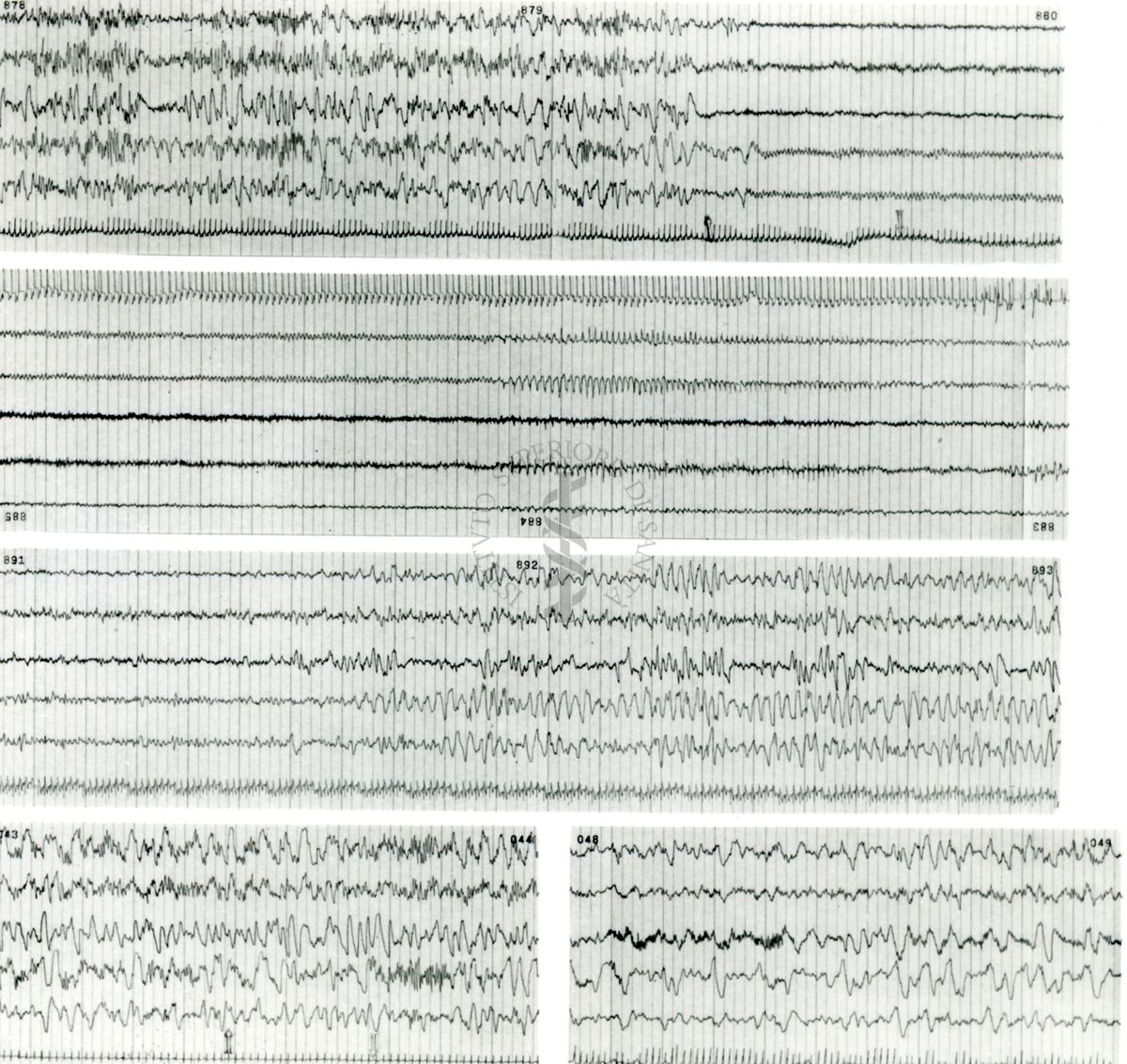 Tracciati elettroencefalografici di coniglio