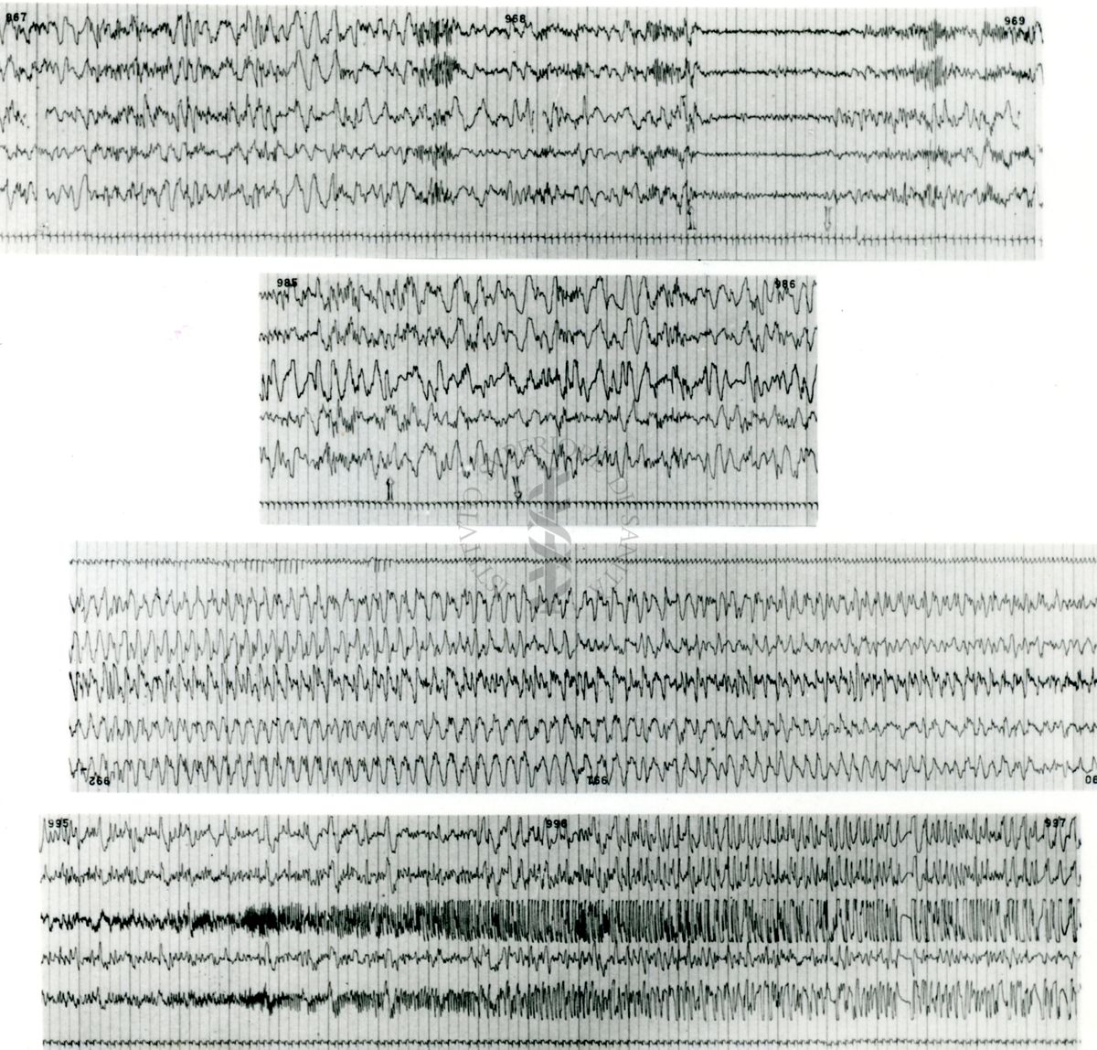 Tracciati elettroencefalografici di coniglio