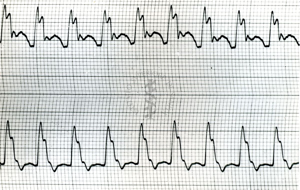 Sfigmogrammi del polso centrale del cane