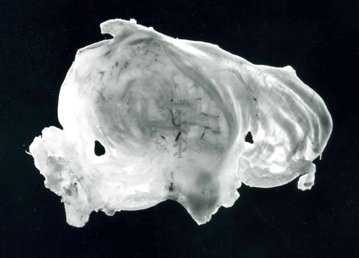 Immagine di stomaco di ratto cui è stata provocata l'ulcera gastrica sperimentale: alcune ulcere in seguito al trattamento con 100 mg / 1 Kg di Fenergan