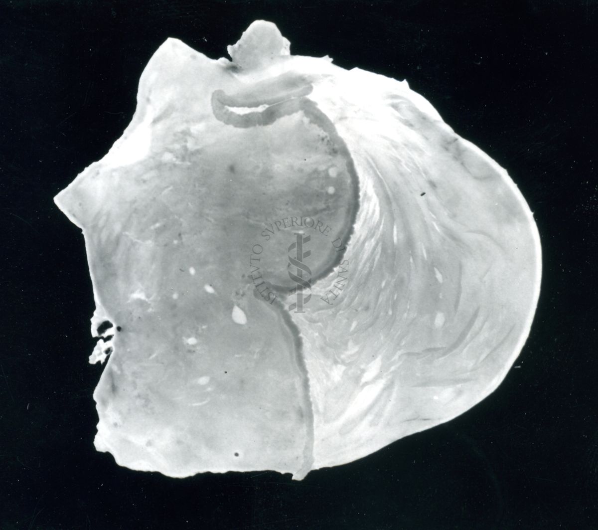 Immagine di stomaco di ratto cui è stata provocata l'ulcera gastrica sperimentale: stomaco normale in seguito a trattamento con 100 mg / 1 Kg di Parsidol