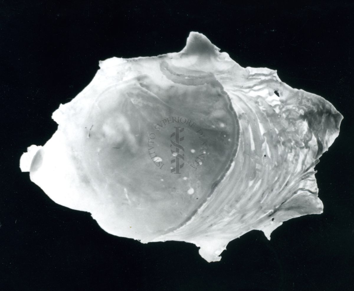 Immagine di stomaco di ratto cui è stata provocata l'ulcera gastrica sperimentale: stomaco normale in seguito a trattamento con 100 mg / 1 Kg di Parsidol