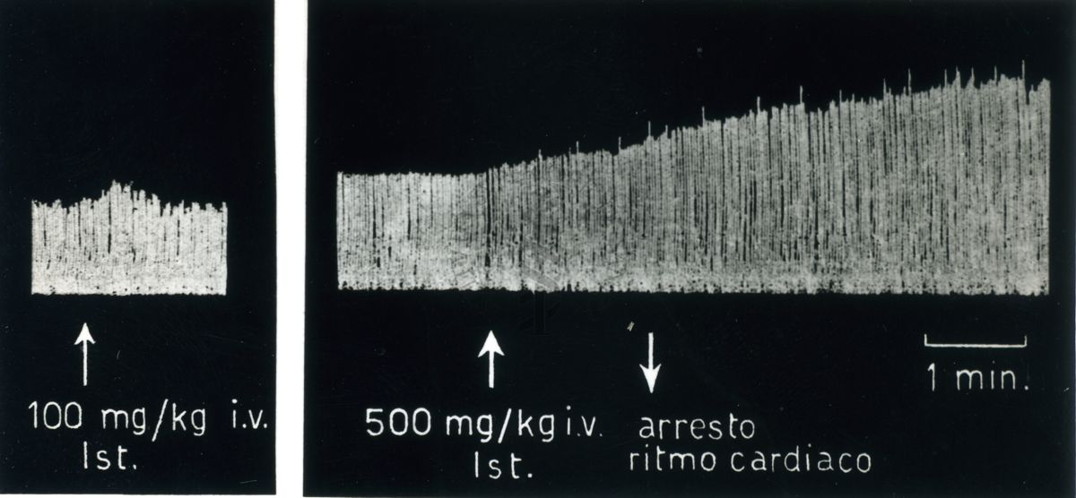 Tracciati broncografici riguardanti l'azione dell'Istamina