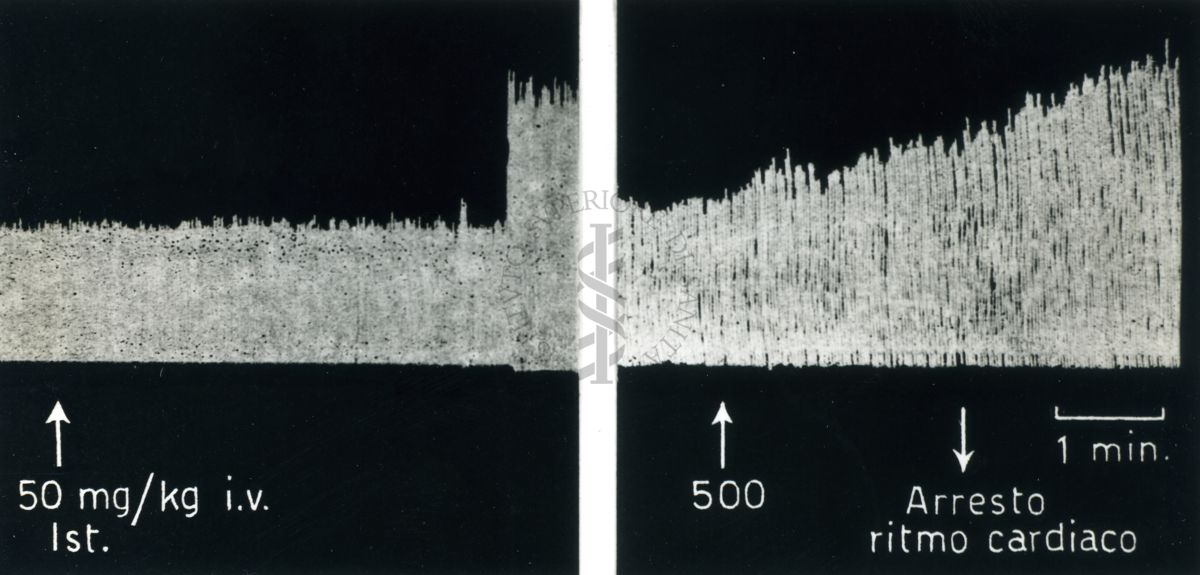 Tracciati broncografici riguardanti l'azione dell'Istamina