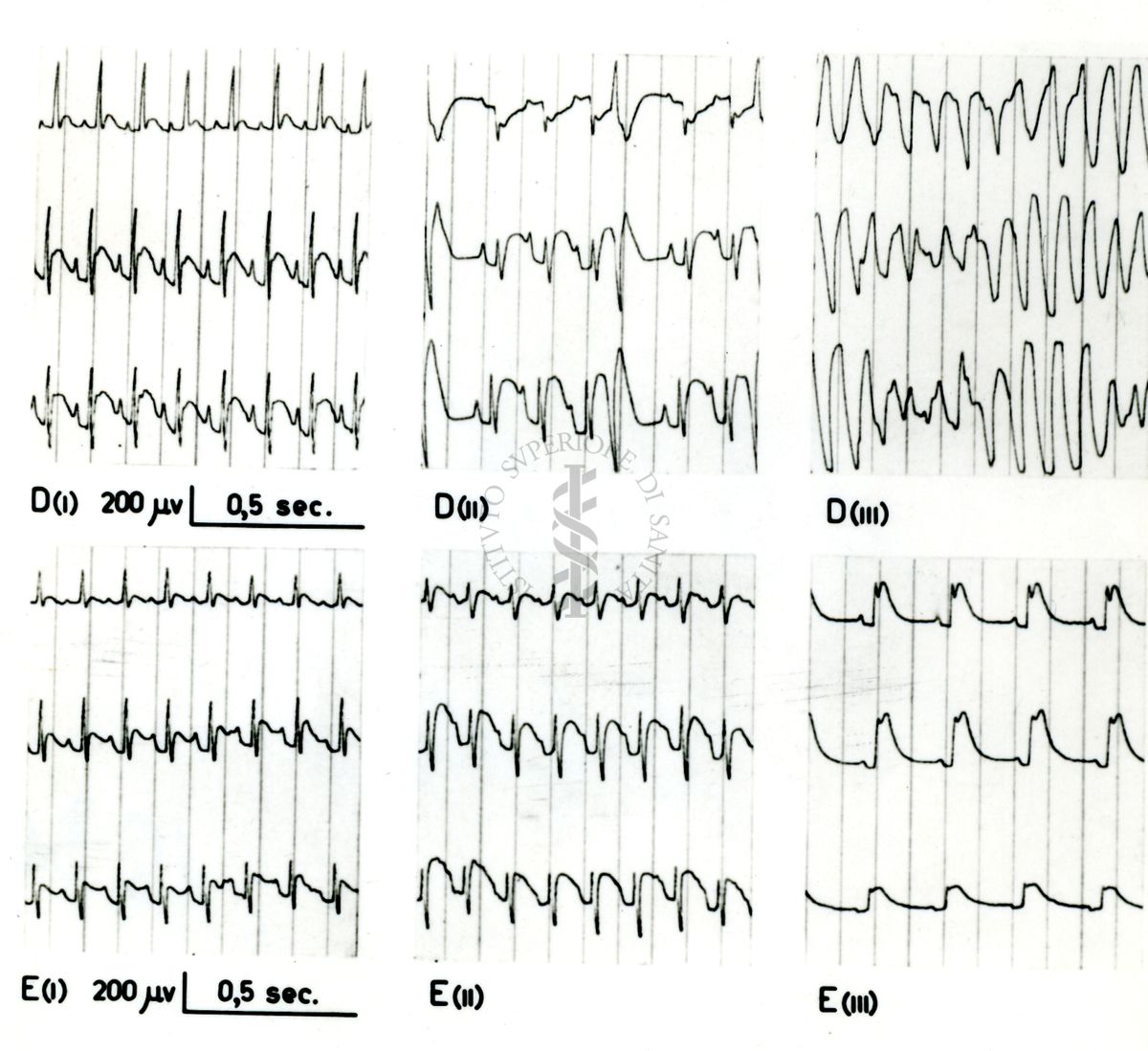 Tracciati broncografici riguardanti l'azione dell'Istamina