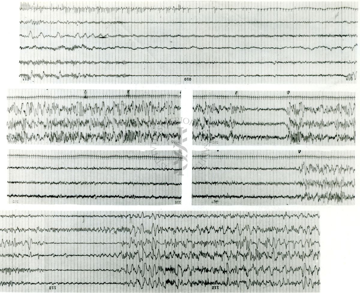 Tracciati elettroencefalografici di coniglio