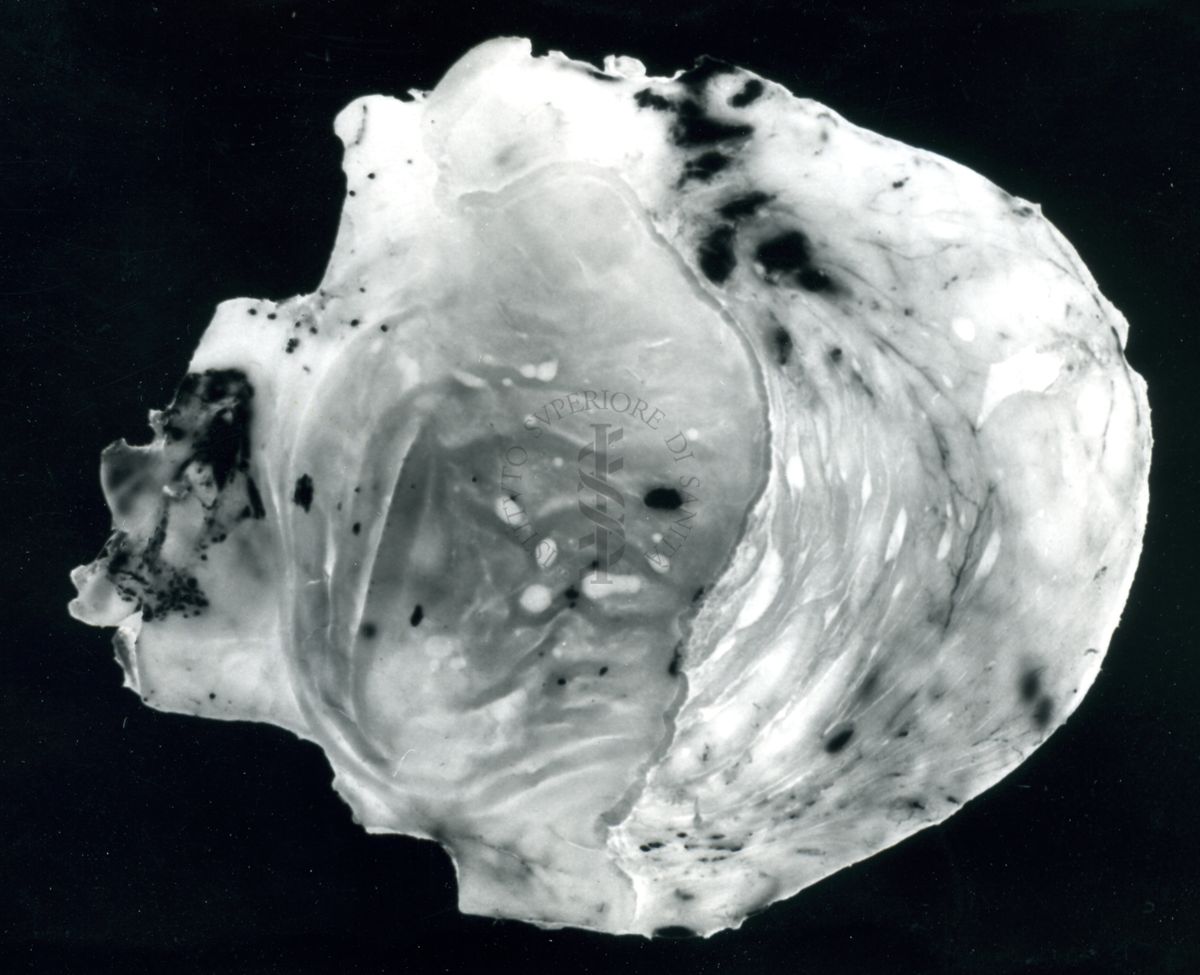 Immagine di stomaco di ratto cui è stata provocata l'ulcera gastrica sperimentale: stomaco con molte ulcere