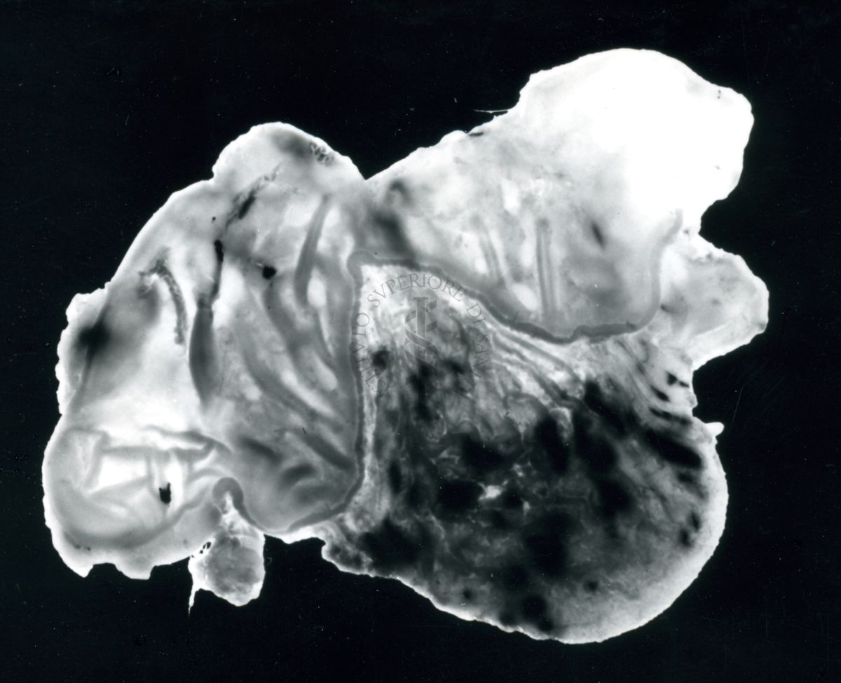 Immagine di stomaco di ratto cui è stata provocata l'ulcera gastrica sperimentale e prodotti iniettati per prevenirla