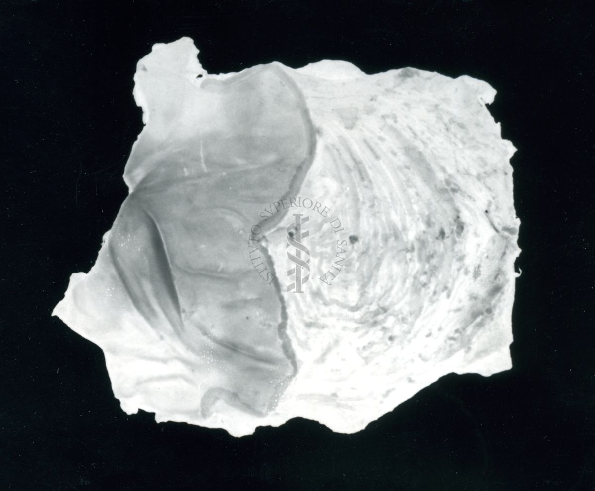 Immagine di stomaco di ratto cui è stata provocata l'ulcera gastrica sperimentale e prodotti iniettati per prevenirla - trattato con Diparkol