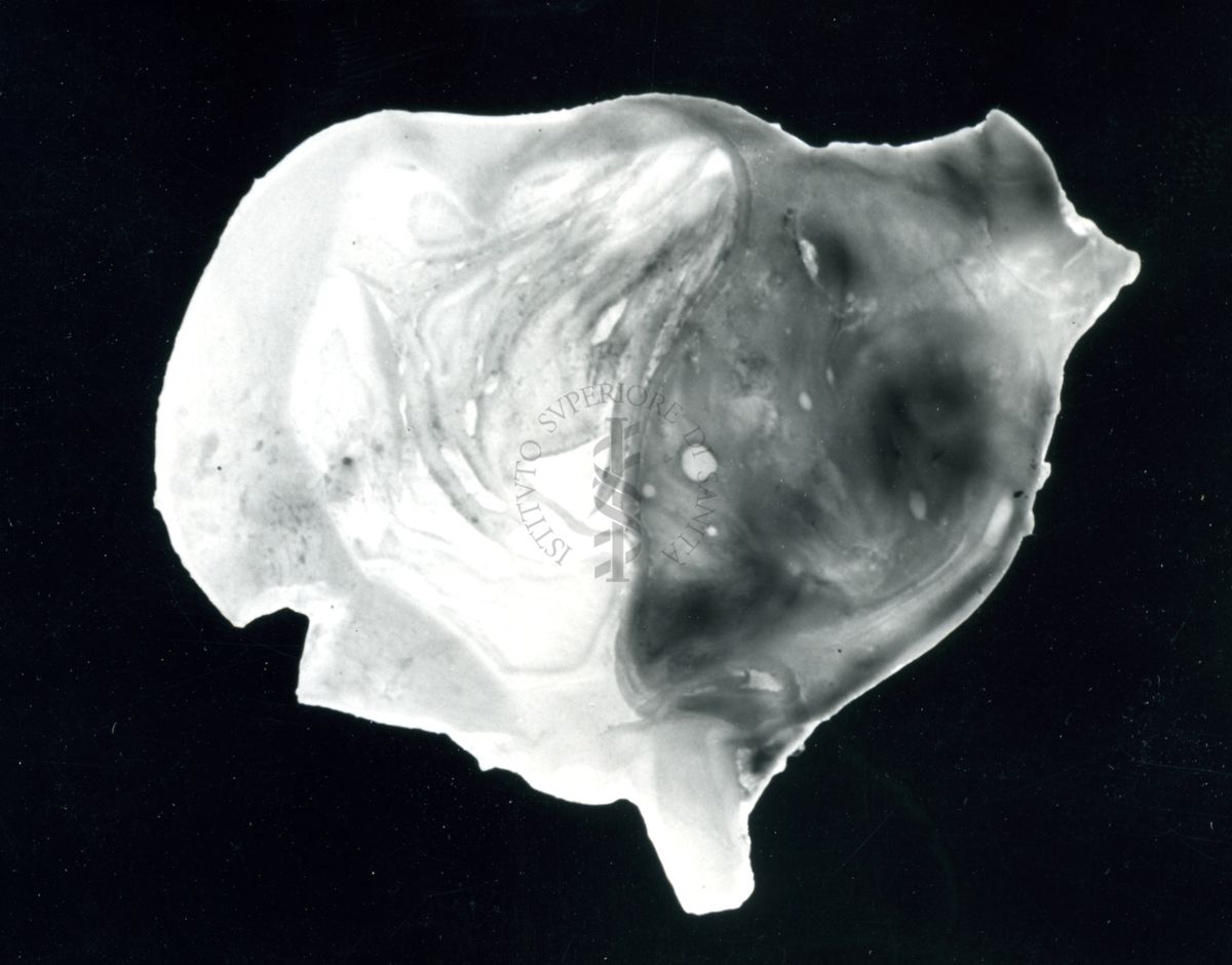 Immagine di stomaco di ratto cui è stata provocata l'ulcera gastrica sperimentale e prodotti iniettati per prevenirla - trattato con Neo Antergan