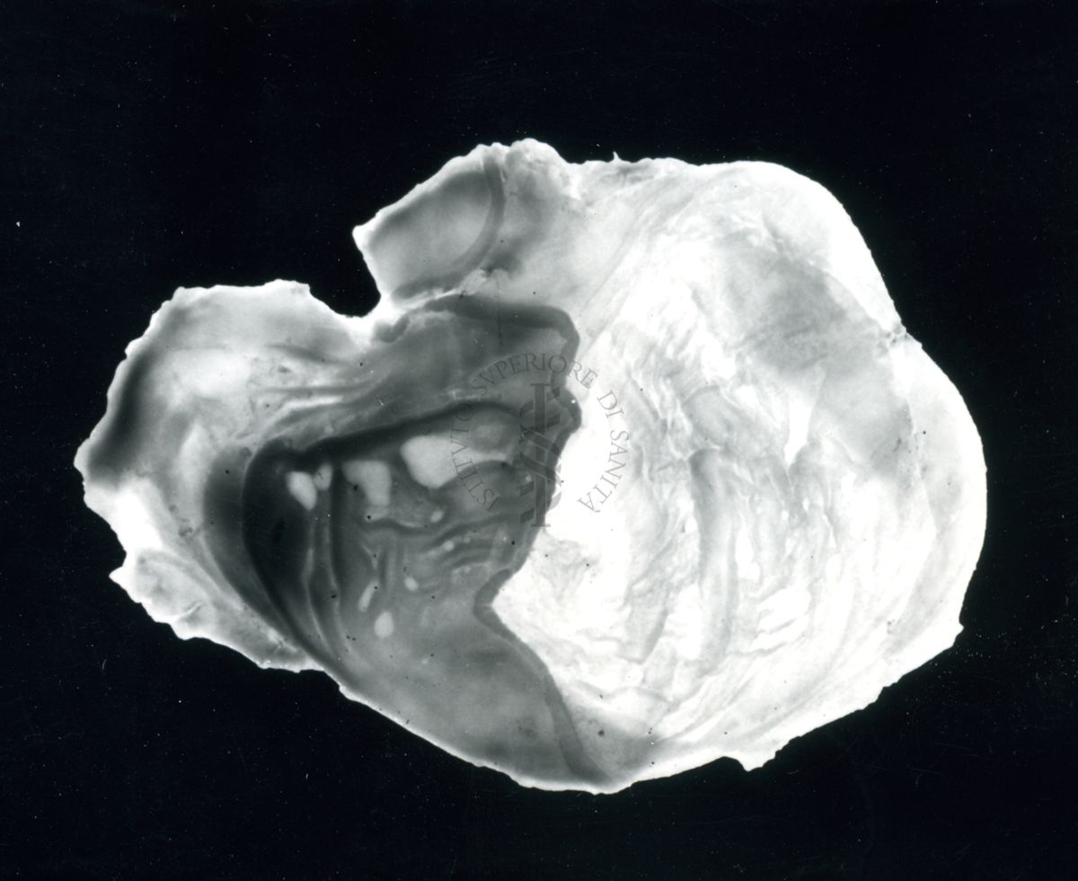 Immagine di stomaco di ratto cui è stata provocata l'ulcera gastrica sperimentale e prodotti iniettati per prevenirla - trattato con Neo Antergan