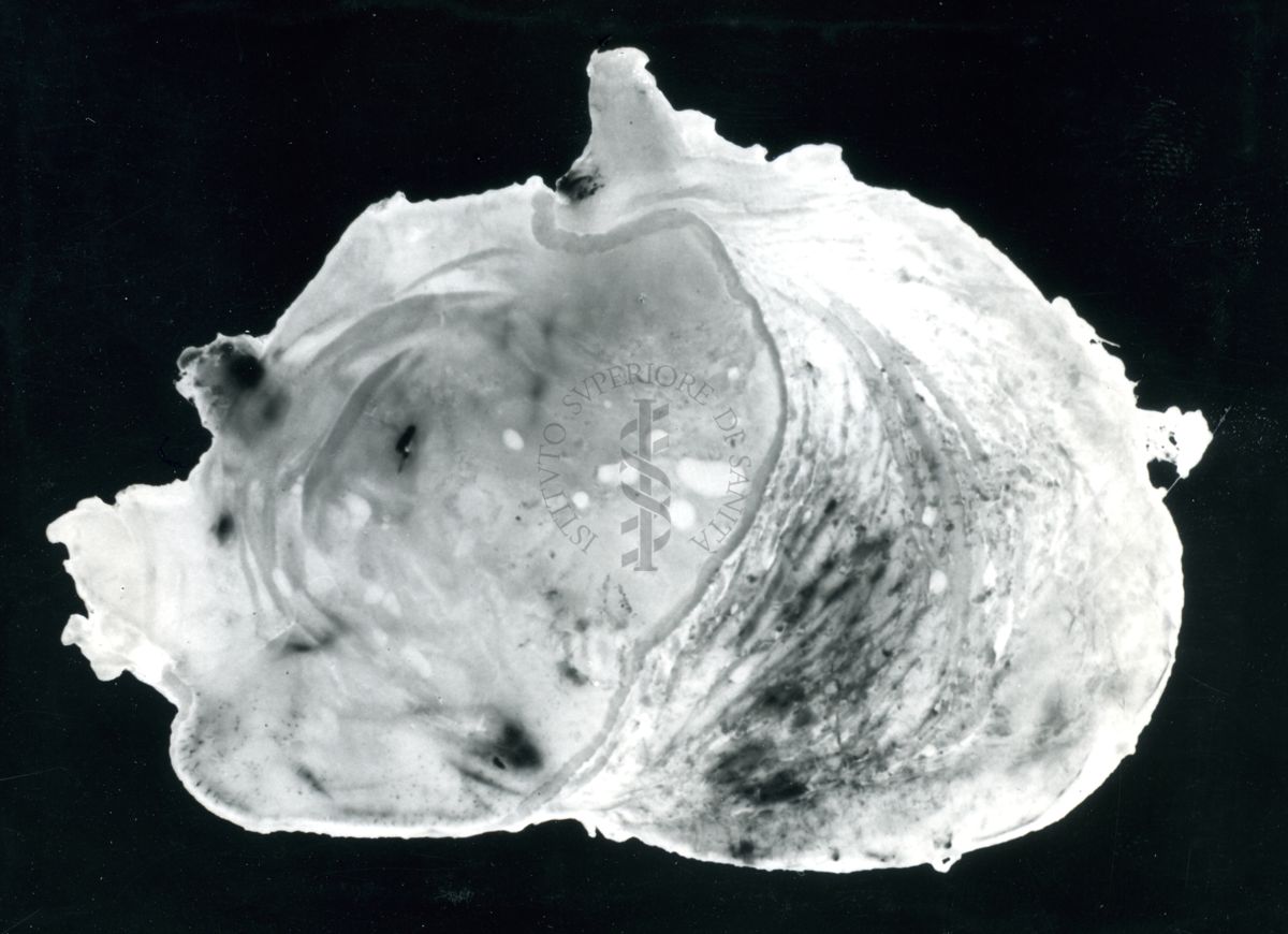 Immagine di stomaco di ratto cui è stata provocata l'ulcera gastrica sperimentale e prodotti iniettati per prevenirla - trattato con 3015
