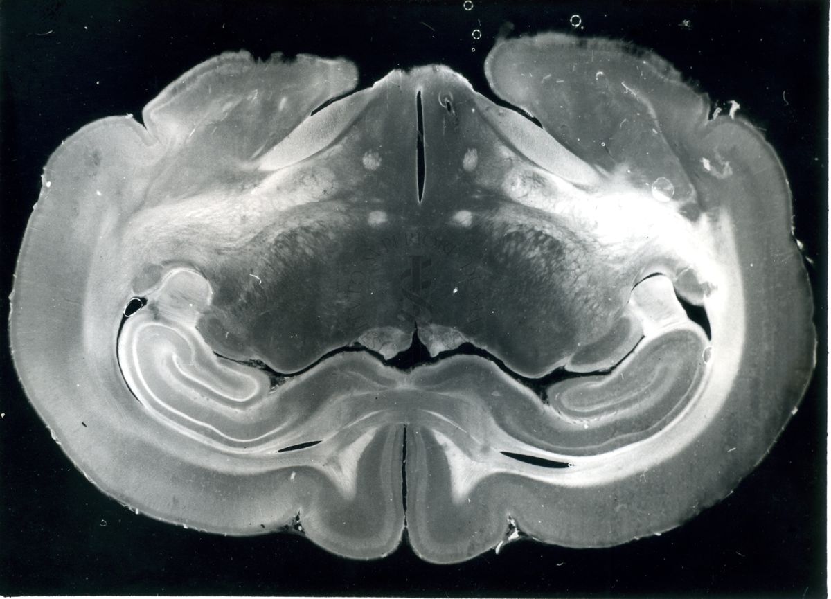 Sezioni di cervello di coniglio