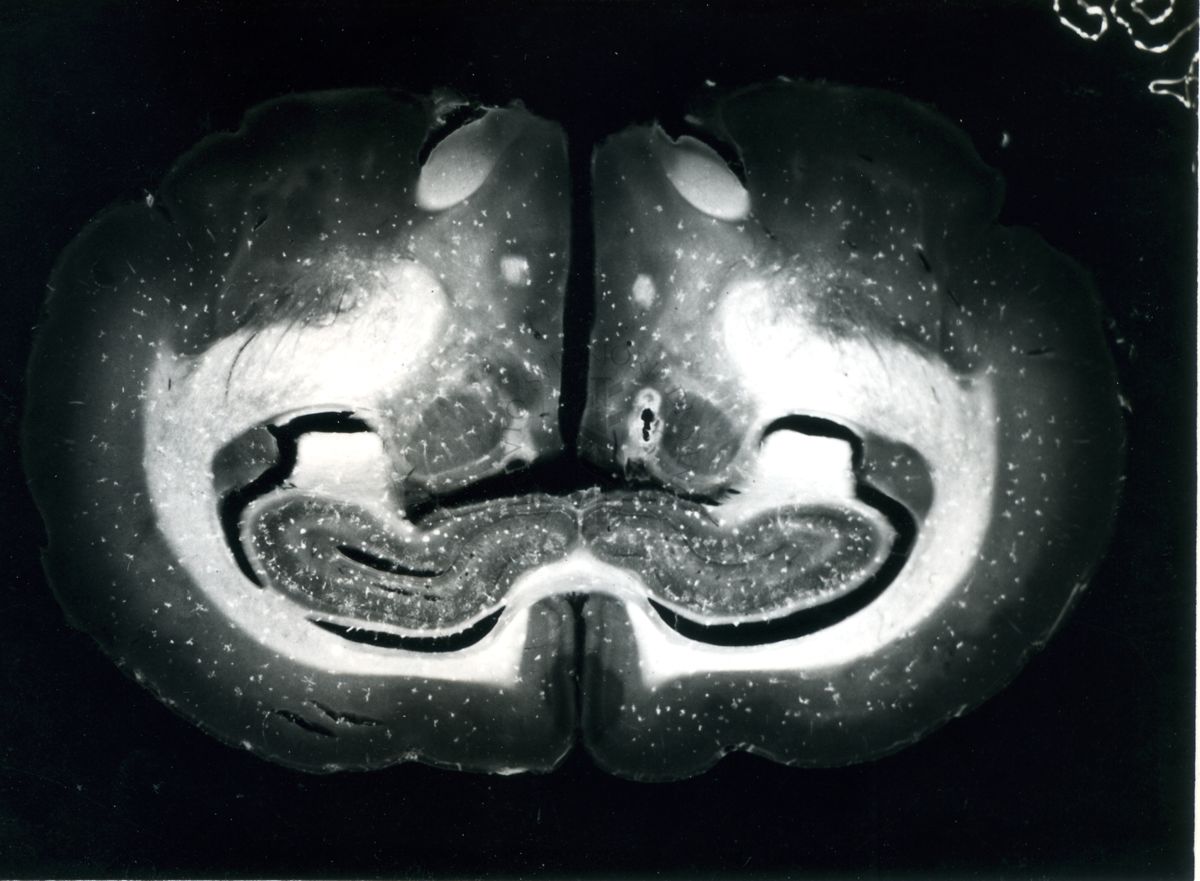 Sezioni di cervello di coniglio