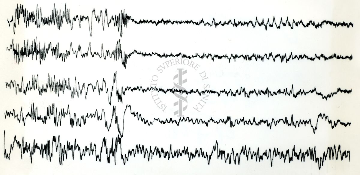 Tracciati elettroncefalografici di coniglio